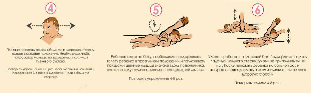 Кривошея - причины, признаки, методы лечения. кривошея у новорожденных :: polismed.com