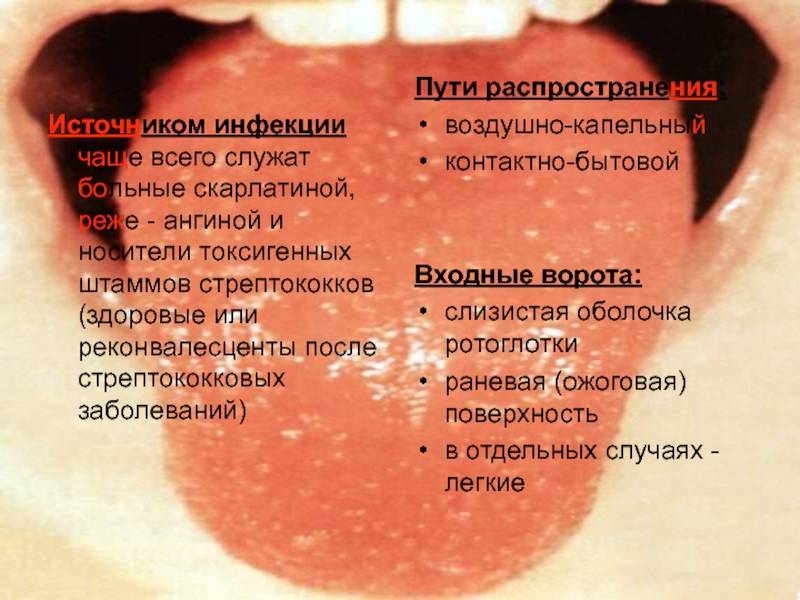Ангина вирусная и бактериальная