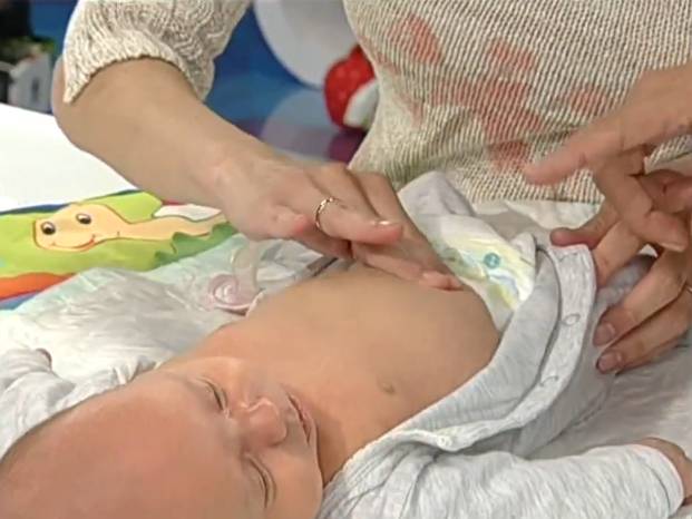 Массаж при пупочной грыже у новорожденных ребенка