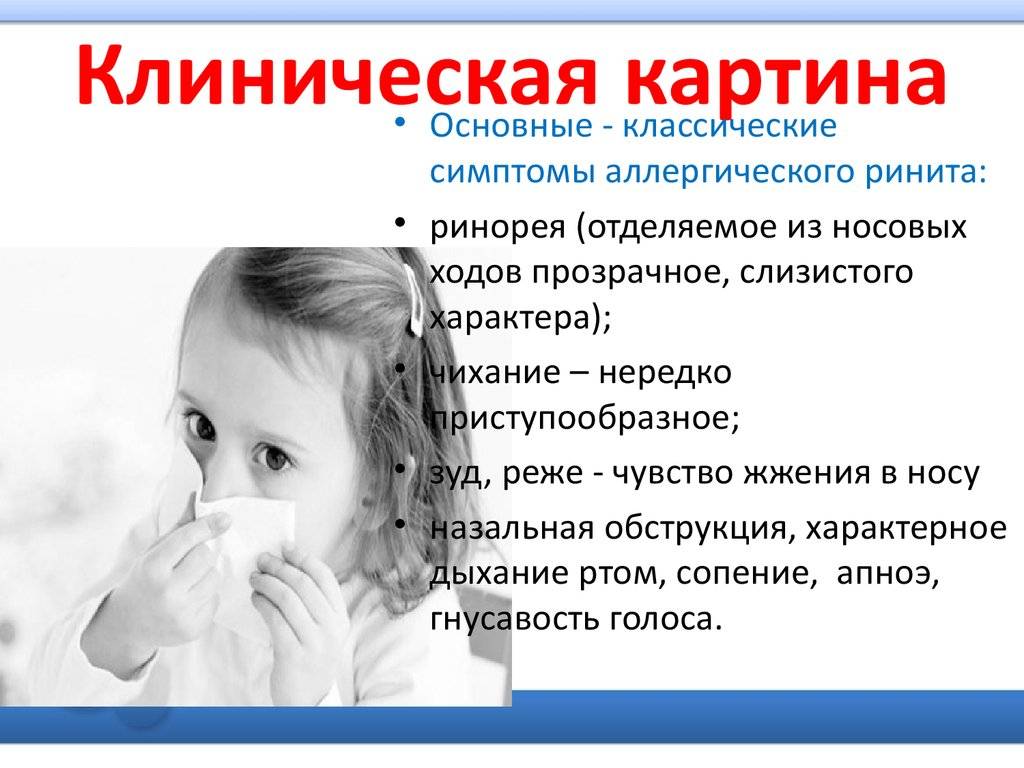Топ препаратов от аллергии (антигистаминные)