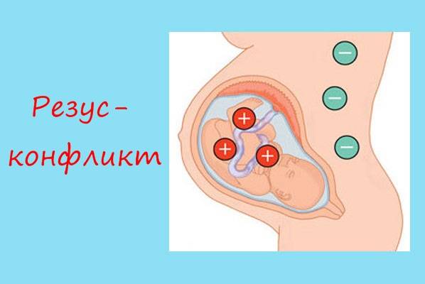 Определение резус-фактора плода по крови беременной женщины