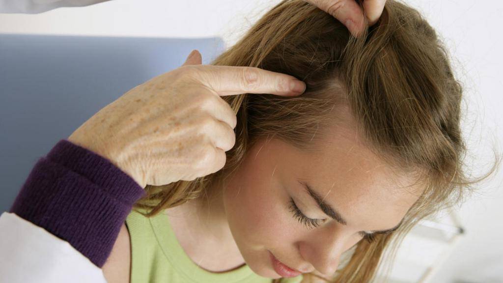 Какие заболевания провоцируют выпадение волос у женщин