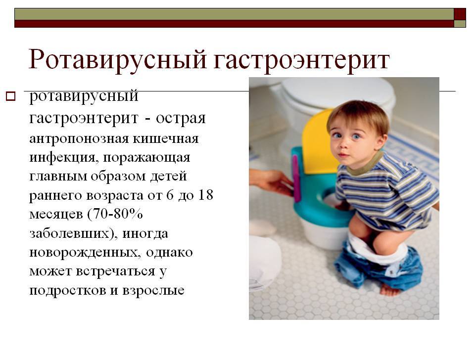 Какие бывают конъюнктивиты у детей