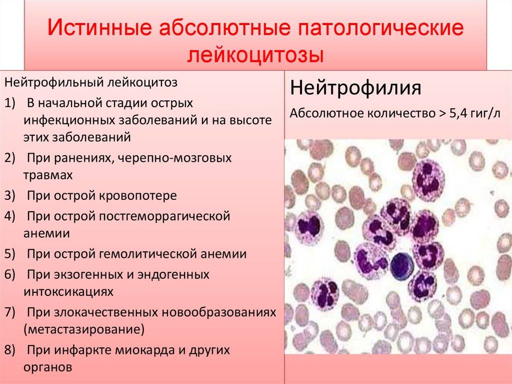 Повышены лейкоциты в крови у ребенка: причины лейкоцитоза у новорожденных и деток от 1 года