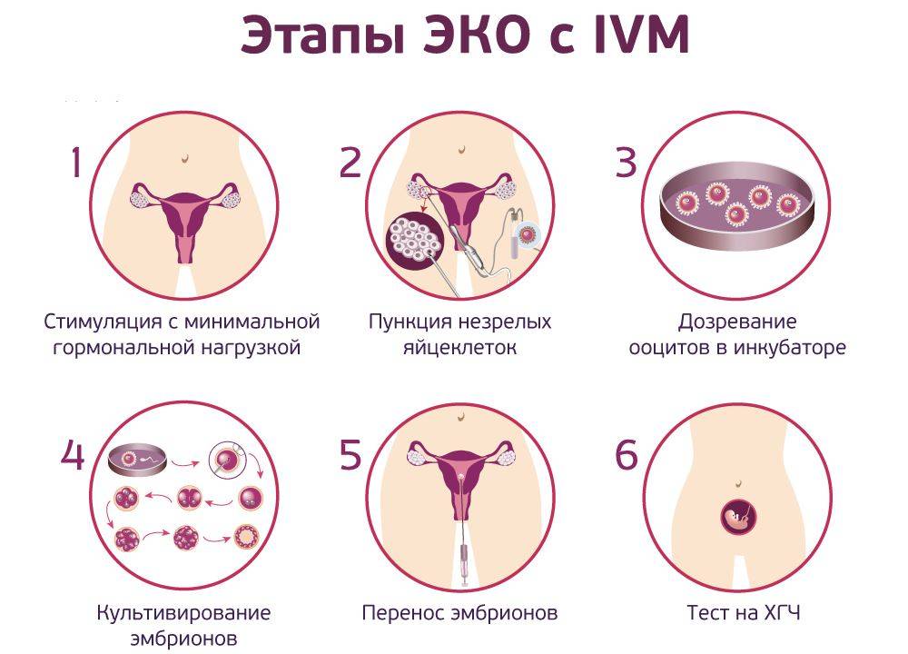Заморозка яйцеклеток: как происходит - статья репродуктивного центра «за рождение»