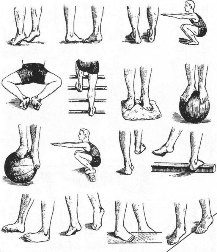 Плоско-вальгусная деформация стопы – как лечить