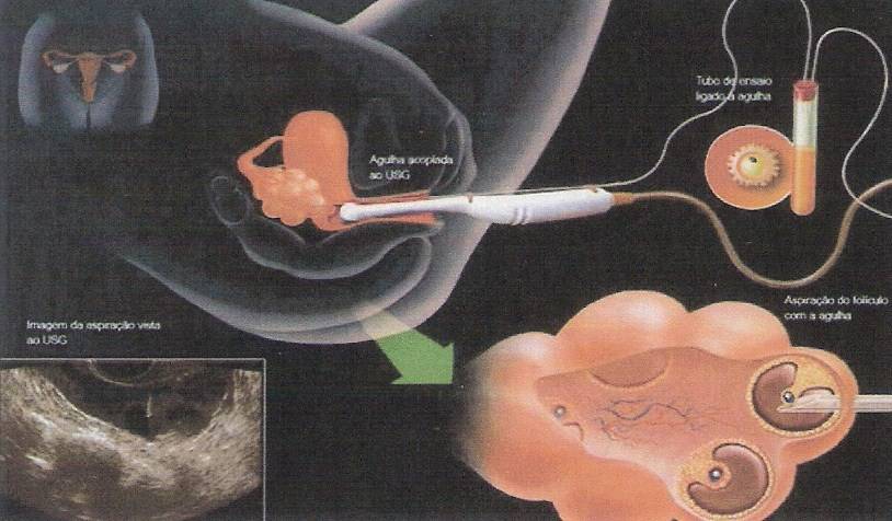 9 день после переноса эмбрионов