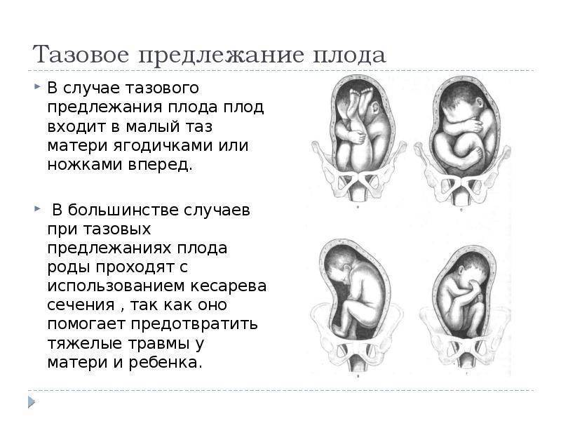 Положение ребенка в животе по неделям в картинках