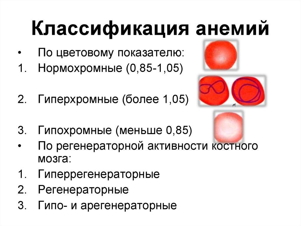 Недостаточное содержание эритроцитов латынь. Анемия классификация показатели крови. Классификация анемий по показателям крови. Классификация анемий по эритроцитам. 2. Классификация анемий..