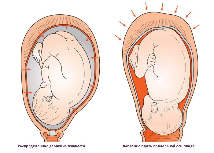Матка расположена низко при беременности - причины и лечение