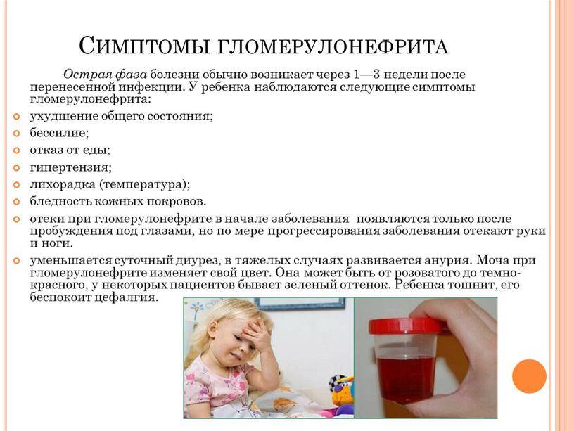 Гломерулонефрит у детей