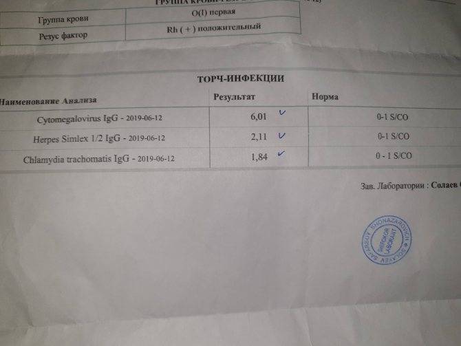 Антитела к вирусу краснухи lgm, rubella igm колич.
