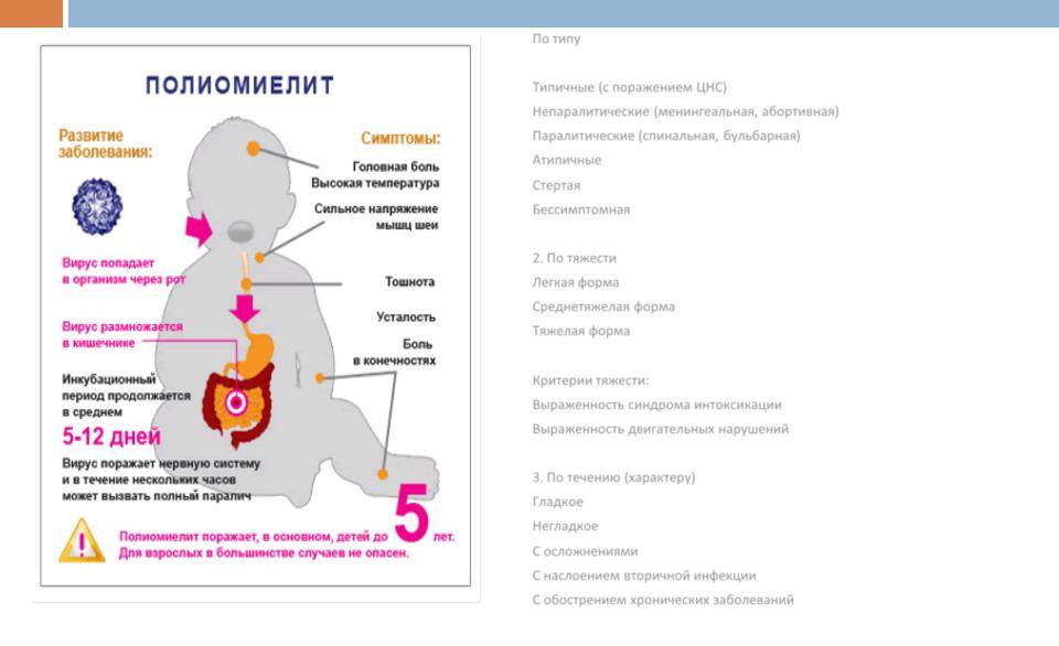 Полиомиелит