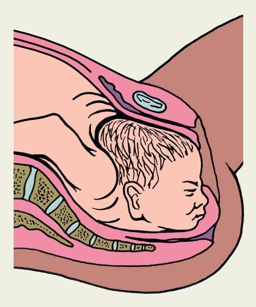 Как начинаются роды: как понять, что родовой процесс приближается, через сколько после отхождения пробки, признаки у первородящих и повторнородящих