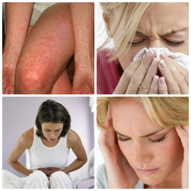 Лечение аллергии