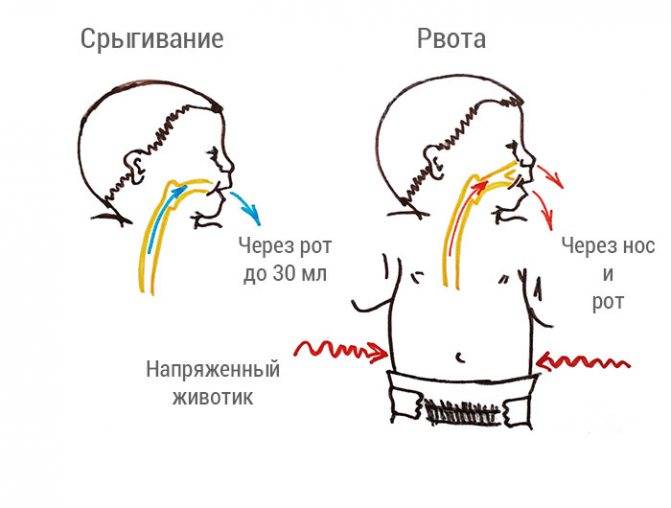 Что делать, если ребенок срыгивает фонтаном?