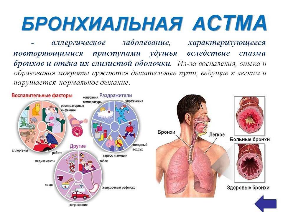 Астма.  клиническая картина астмы и астматического статуса.