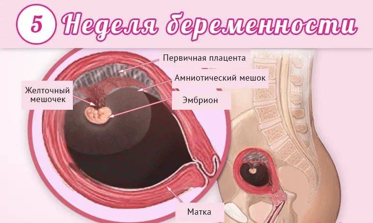 5 неделя беременности: признаки, симптомы и ощущения – что происходит с плодом на пятой неделе беременности — медицинский женский центр в москве