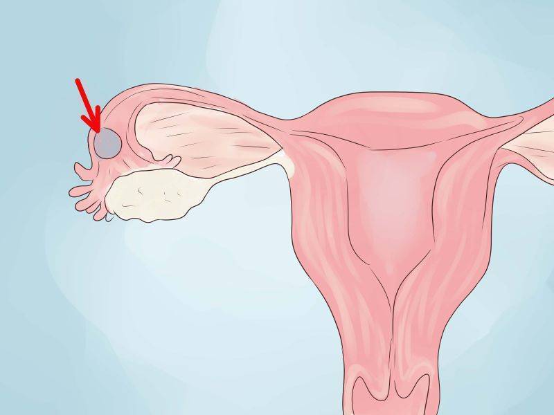 Можно ли забеременеть со спайками в матке или трубах и как протекает беременность?