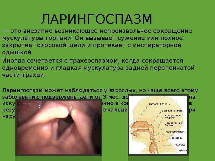 Лечение ангины у взрослых