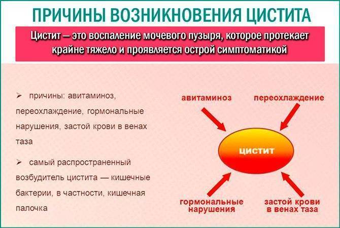 Топ-15 препаратов при цистите