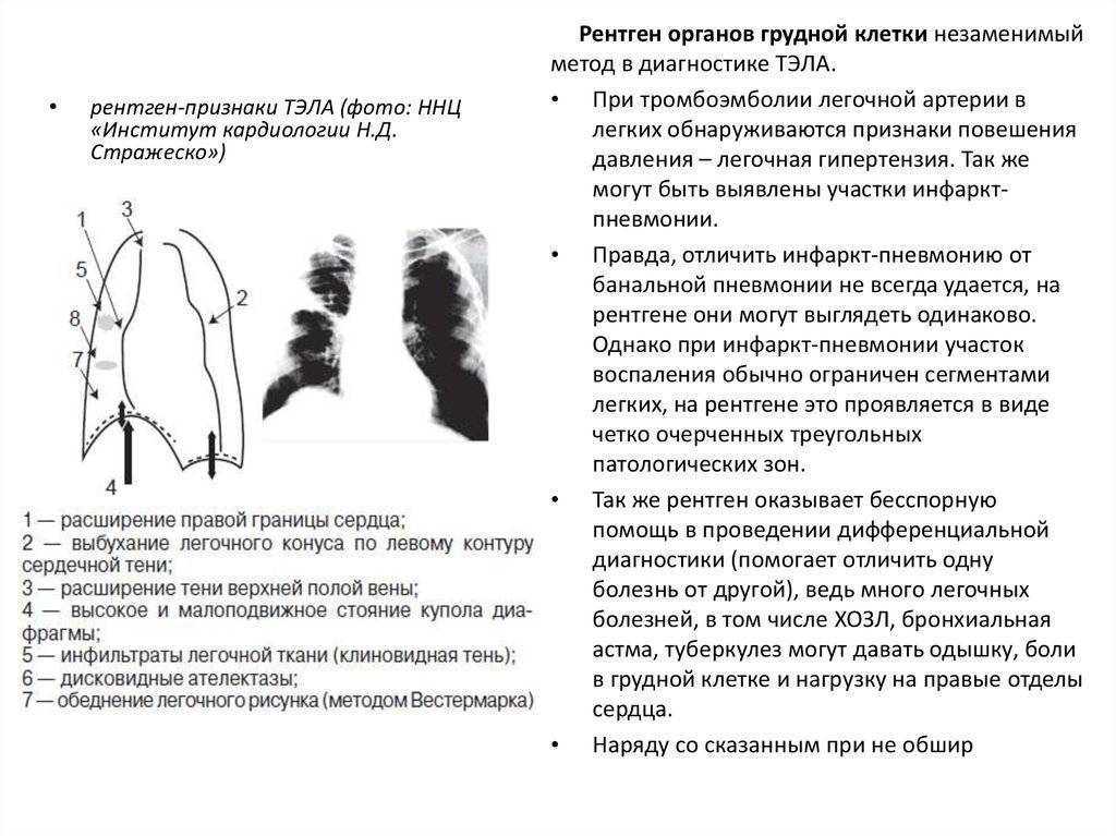 Укладки в рентгенологии в картинках и с описанием для начинающих