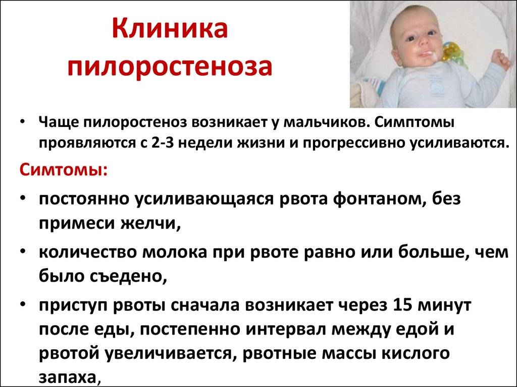Пилороспазм и пилоростеноз у новорожденных: симптоматика, диагностика и лечение - medside.ru