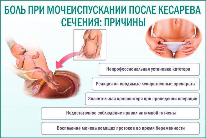 Симптомы болезни - боли при мочеиспускании при беременности