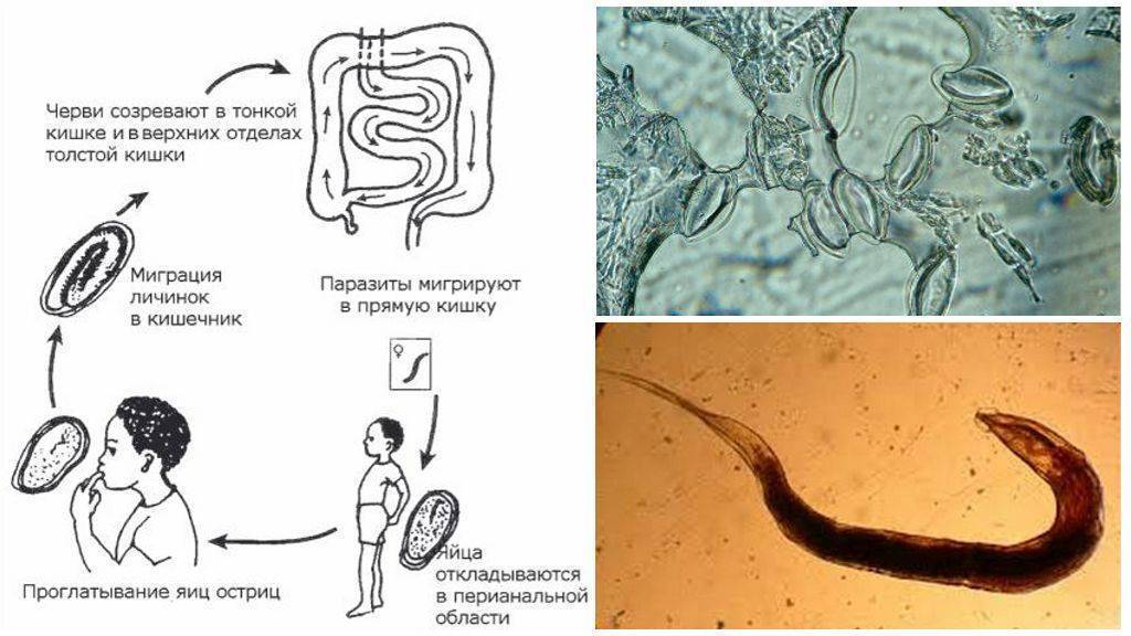 Откуда берутся черви. Жизненный цикл острицы детской (Enterobius vermicularis). Жизненный цикл острицы схема. Циклы развития червей Острица. Энтеробиоз цикл развития остриц.
