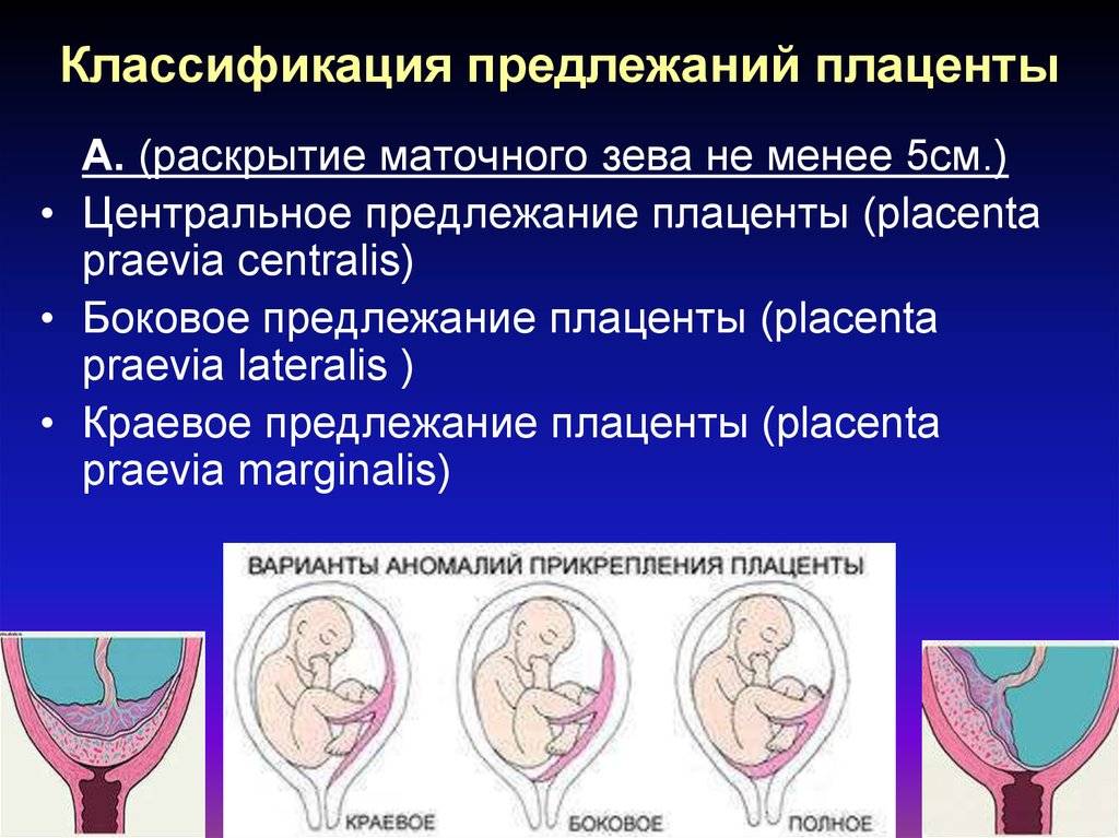 Внутренний зев сомкнут при беременности: что это значит