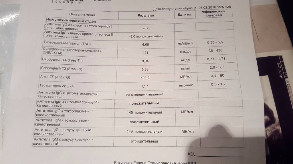 Rubella virus норма при беременности. Антитела к краснухе IGG норма. Антитела g к вирусу краснухи норма. Антитела крови на антитела к кори IGG-. АТ К вирусу краснухи IGG ме/мл.