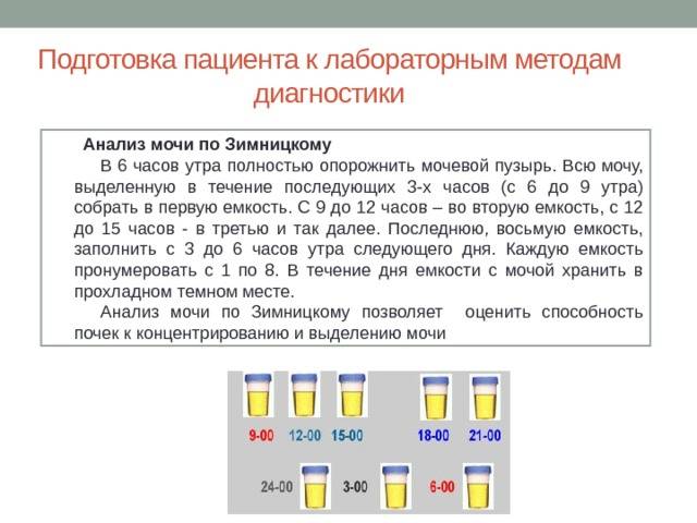 Анализ мочи по зимницкому картинки