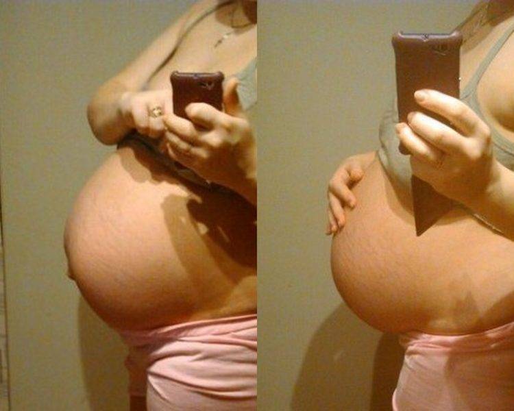 Как понять что живот опустился при беременности: на каком сроке и сколько до родов