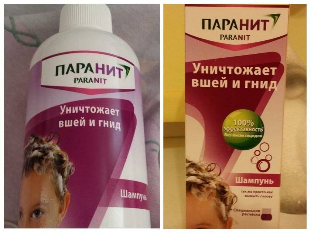 Вши у детей. профилактика и лечение педикулеза