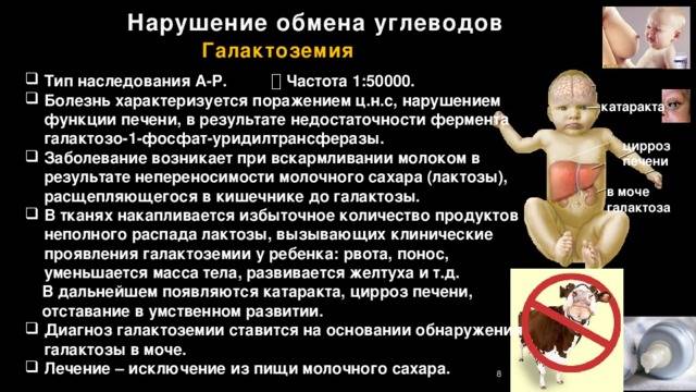 Случай галактоземии у новорожденного ребенка с низкой массой тела | кравченко | медицинский вестник юга россии
