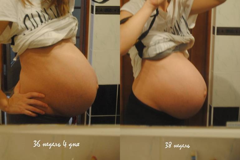 За сколько дней до родов обычно опускается живот и от чего это зависит?