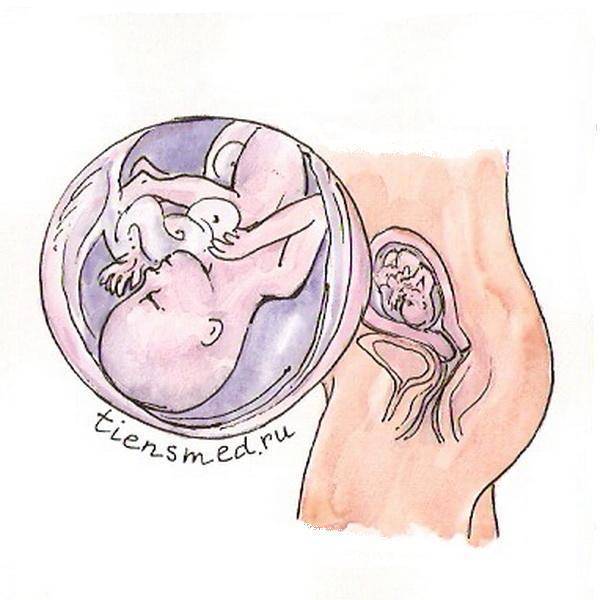 Беременность когда чувствуется первое шевеление. Шевеления плода на 18 неделе беременности. Расположение ребенка на 18 неделе. Расположение ребенка на 18 неделе беременности. Расположение плода на 18 неделе беременности.