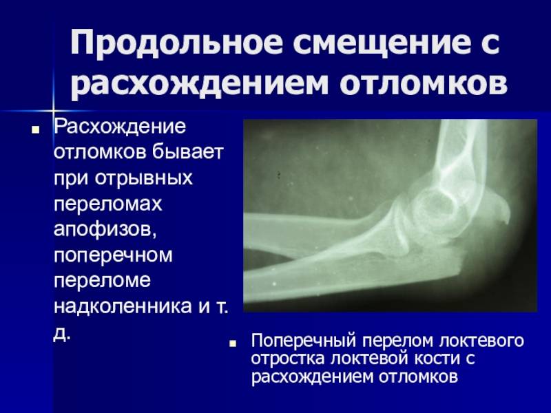 Травмы копчика: что это такое, причины, симптомы и способы лечения - московский центр остеопатии
