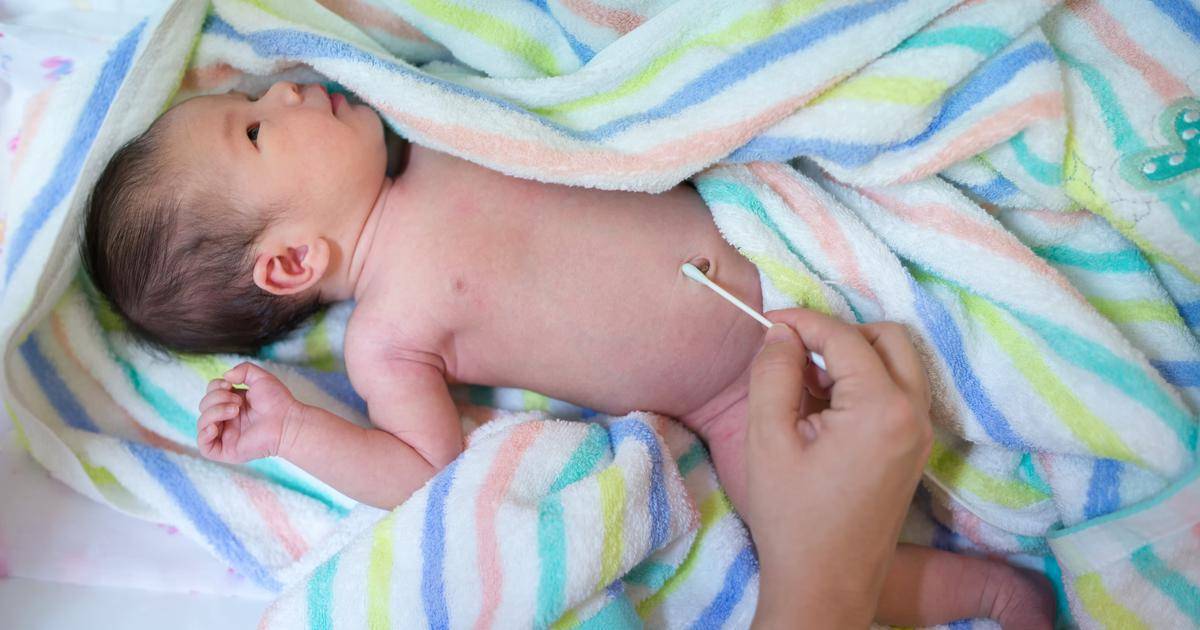 Как обработать пупок новорожденного — правила и советы