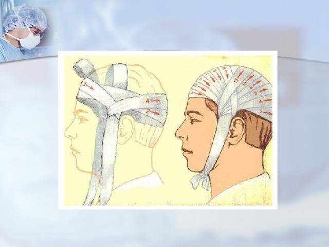 Травмы головы у детей, сотрясение головного мозга, ушиб мозга, контузия, сдавление мозга, внутричерепные гематомы