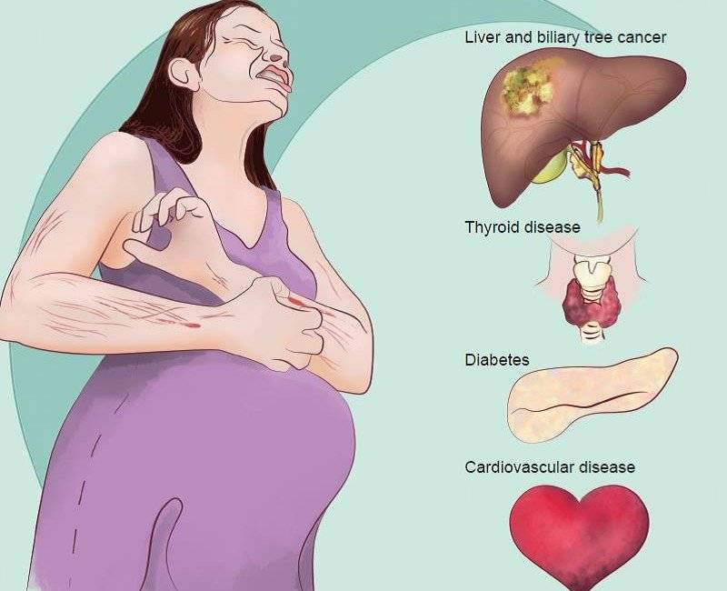 Общие инфекции во время беременности . насколько они опасны?