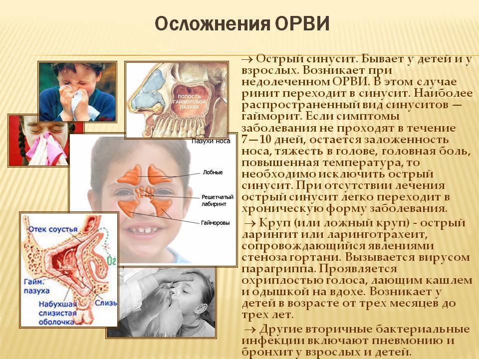 Синусит у детей