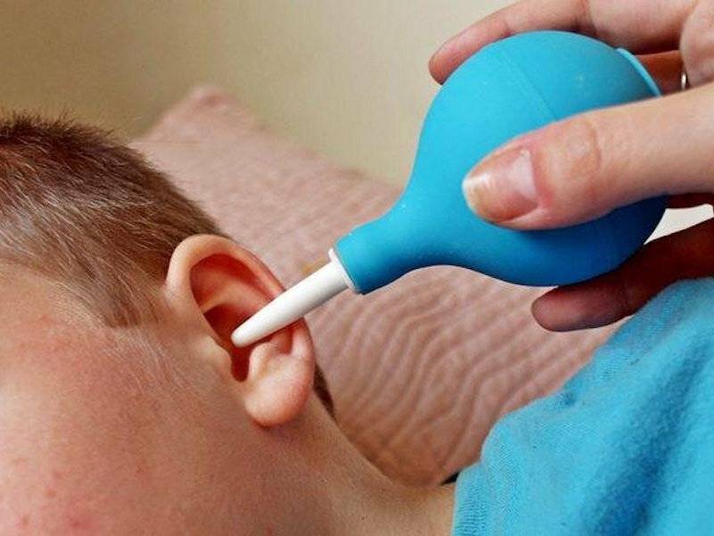Как почистить уши ребенку от серы?
