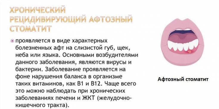 Хейлит: причины, симптомы и методы лечения