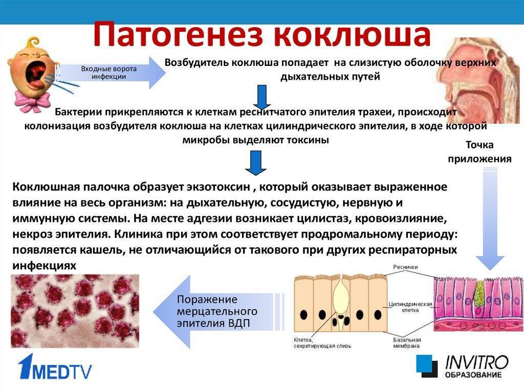 Коклюш у детей: симптомы и лечение (антибиотики, домашние средства), профилактика