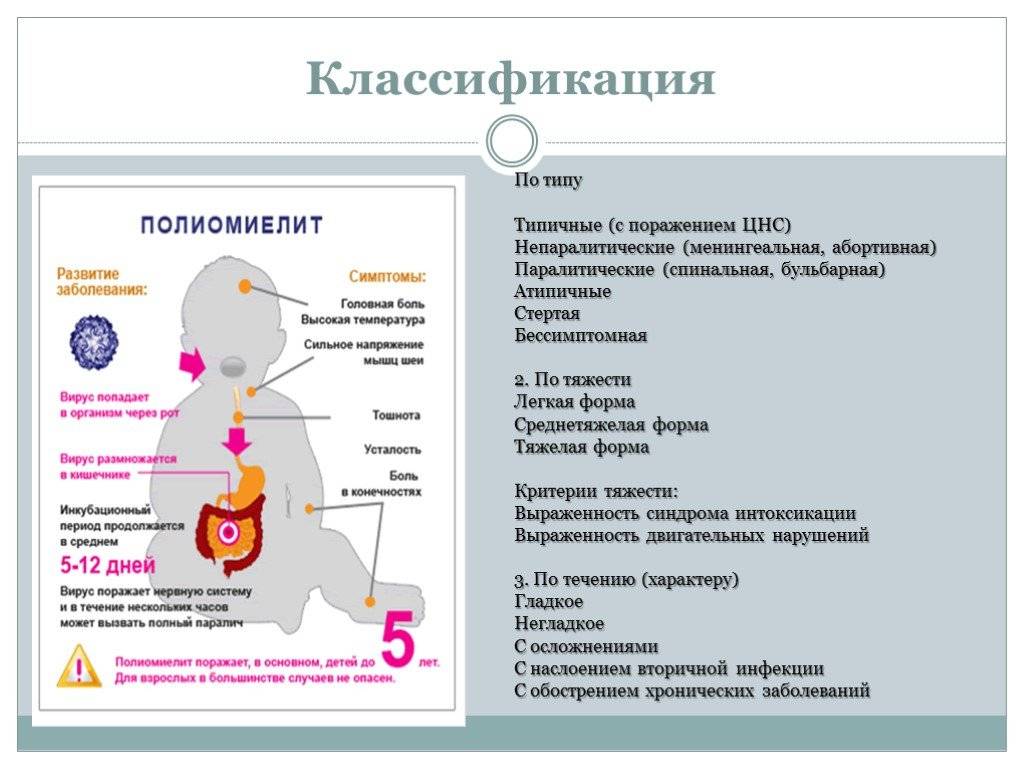 Полиомиелит