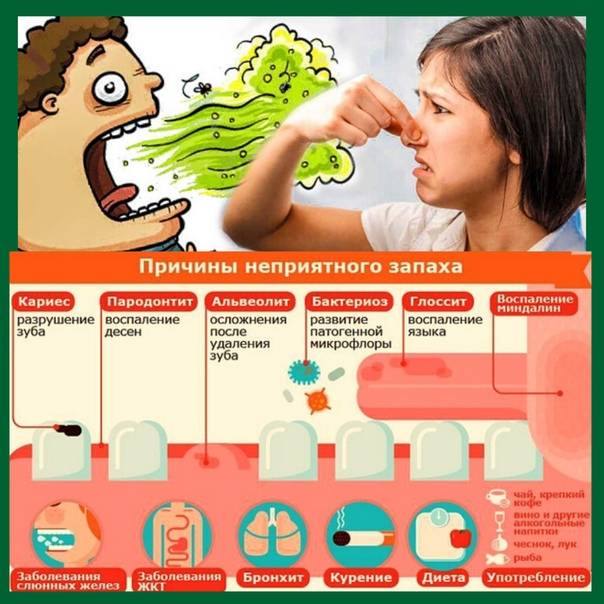 Запах изо рта у ребенка и взрослого: причины, как избавиться от запаха – напоправку