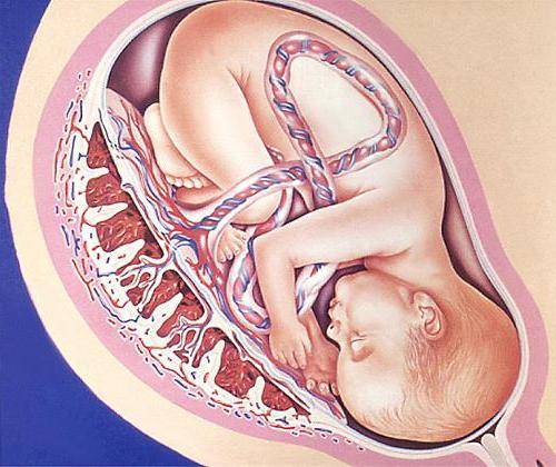 Пуповина имеет 3 сосуда: что это значит, сколько должно быть артерий при беременности?
