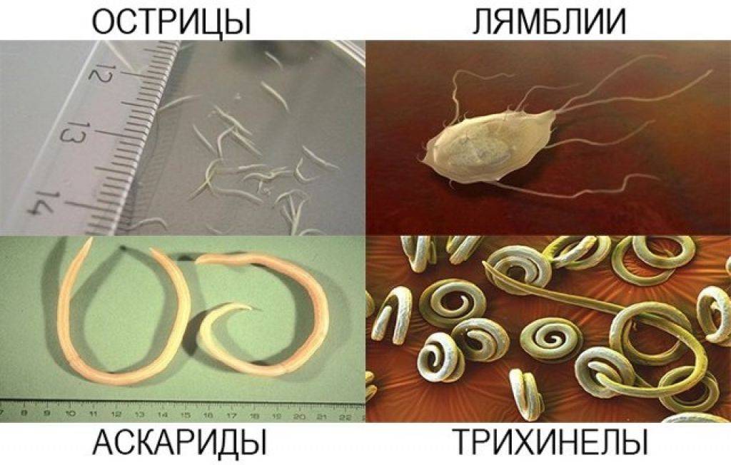 Чем внутренние паразиты отличаются от внутренних паразитов. Гельминты острицы аскариды. Глисты у человека скребни. Черви паразиты Острица. Глисты энтеробиоз острицы.