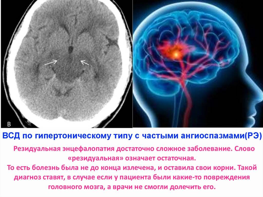 Органические поражения головного мозга